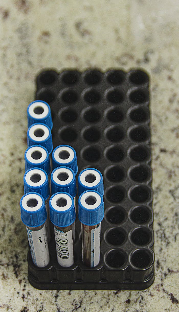 A set of test tubes with blue caps arranged in a laboratory tray on a countertop.
